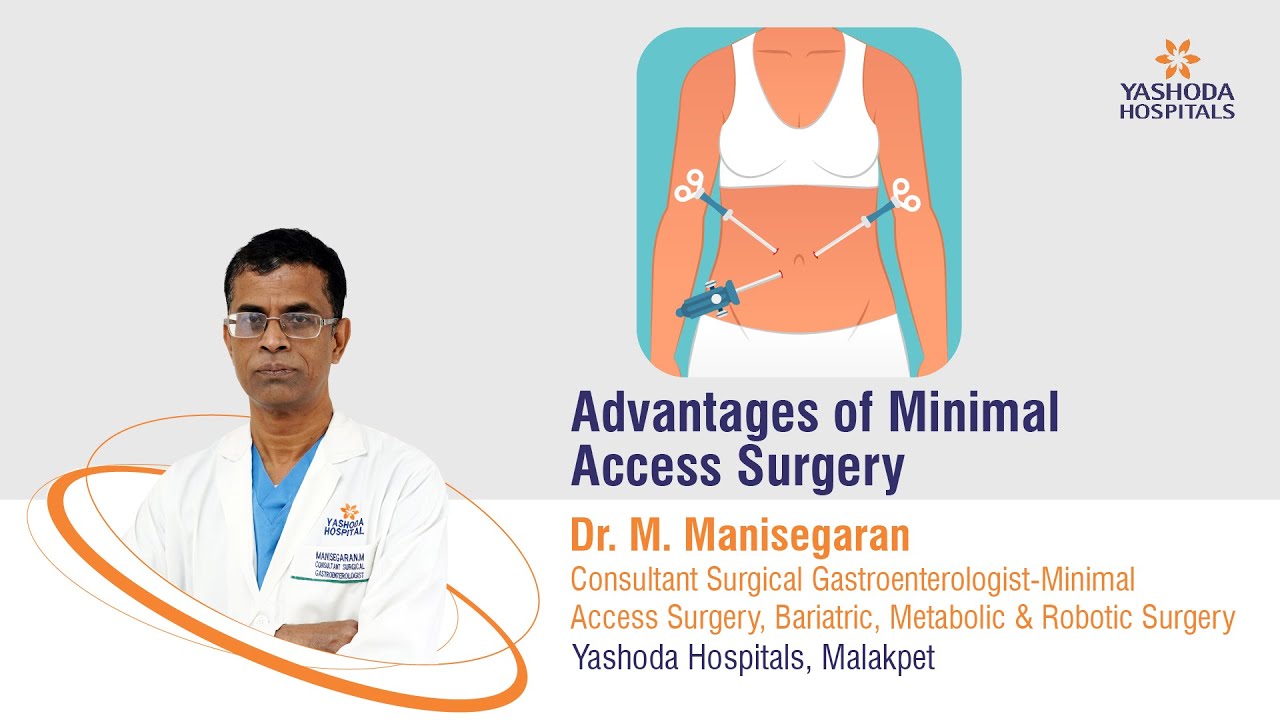 Advantages of Minimal Access Surgery | Yashoda Hospitals Hyderabad