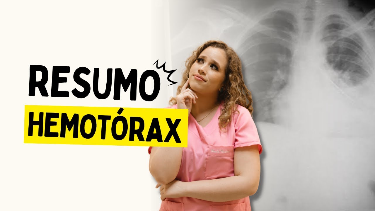 HEMOT&Oacute;RAX RESUMO | O que &eacute;, causas, fisiopatologia, sintomas, conduta e graus (com mapa mental pdf)