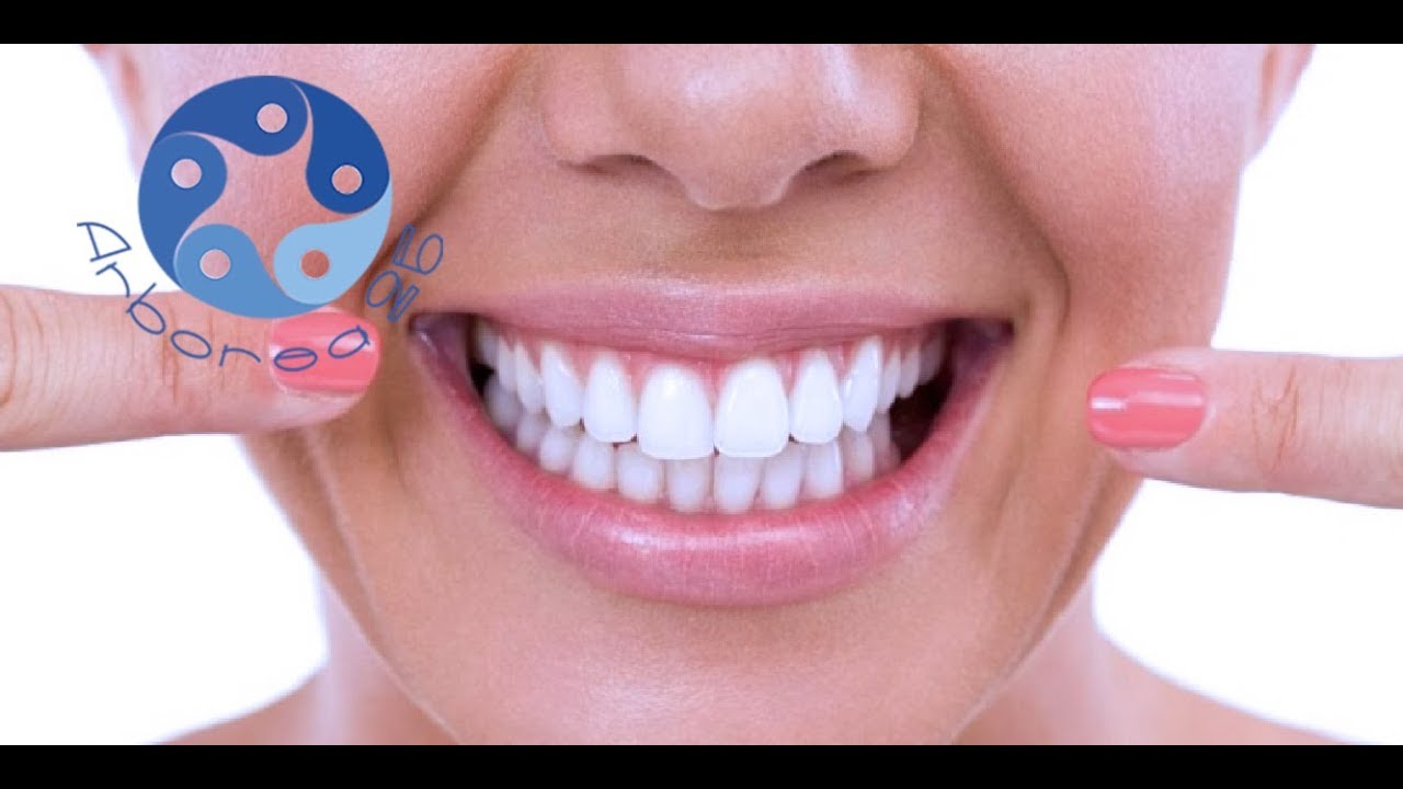 Smacchiamento dentale o sbiancamento: Che differenza c'è?