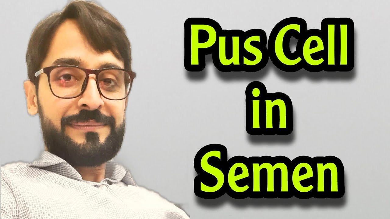 Pyospermia | Leukocytospermia | Leucospermia| Causes | Diagnosis | Treatment