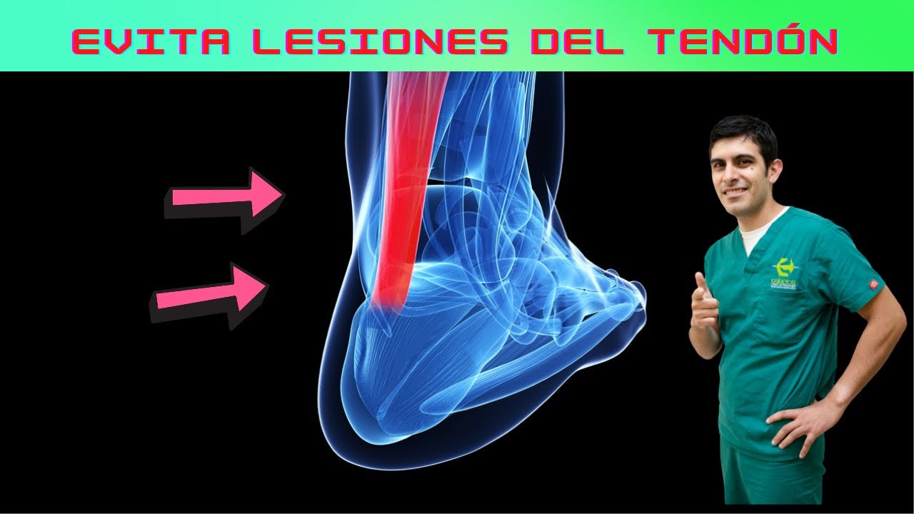 ya NO MÁS lesiones de TENDÓN / cómo tener tus tendones más fuertes