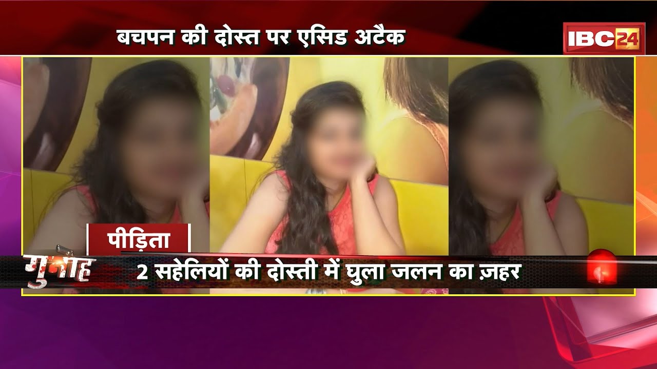 Jabalpur Acid Attack: 2 सहेलियों की दोस्ती में घुला जलन का जहर। इशिका ने श्रद्धा पर किया एसिड अटैक