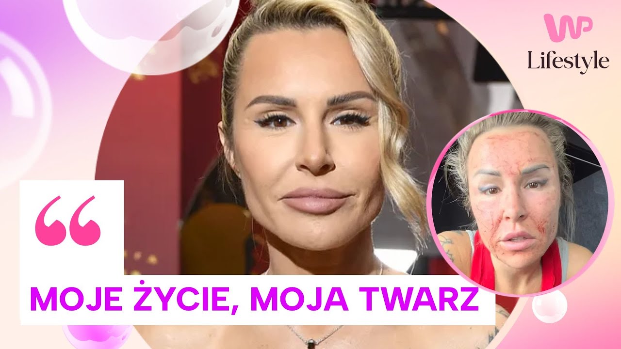 Lipińska zmieniła rysy twarzy! Tak odpowiada na hejt. 