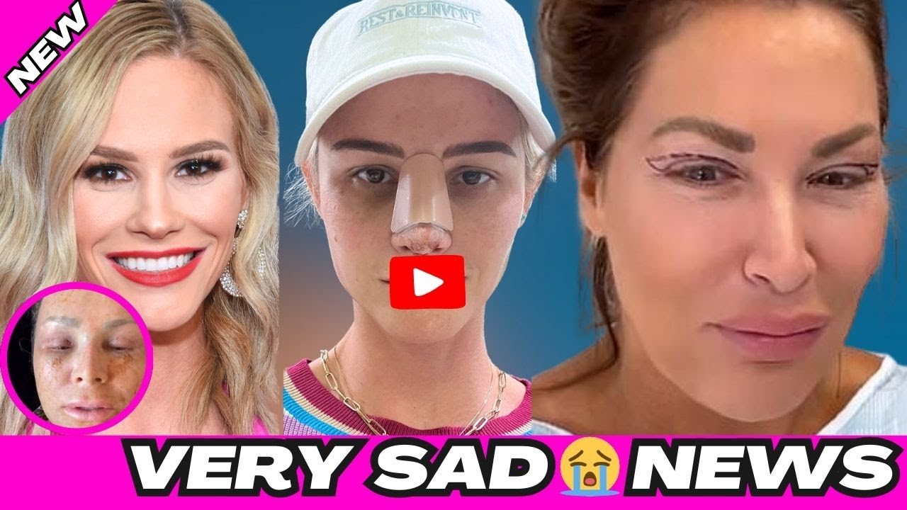Very Sad 😭 Transformation : Real Housewives Star Unrecognizable After Extreme Cosmetic Surgery.