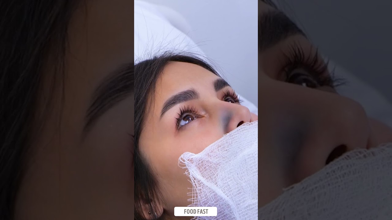 Nose Re-Touching for a Soft, Natural Look 