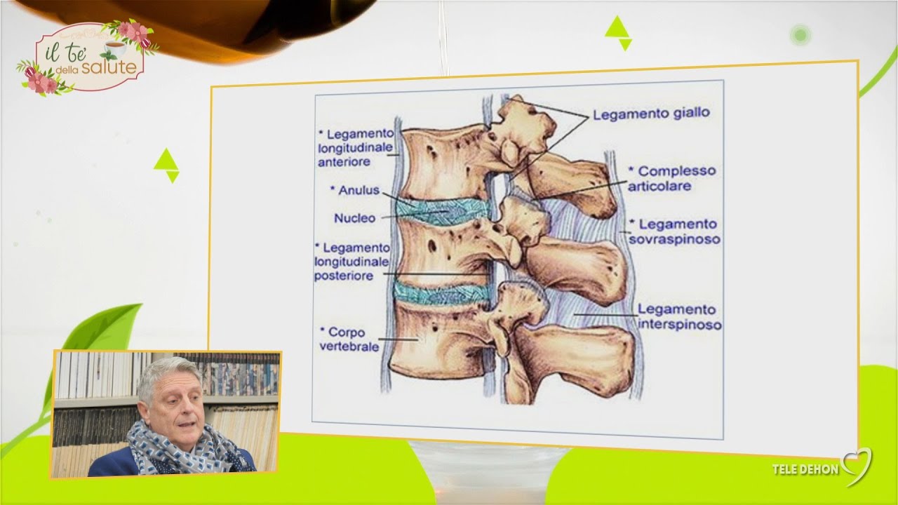 Il Tè della salute 2022-2023 009 Le fratture vertebrali: cause e terapia