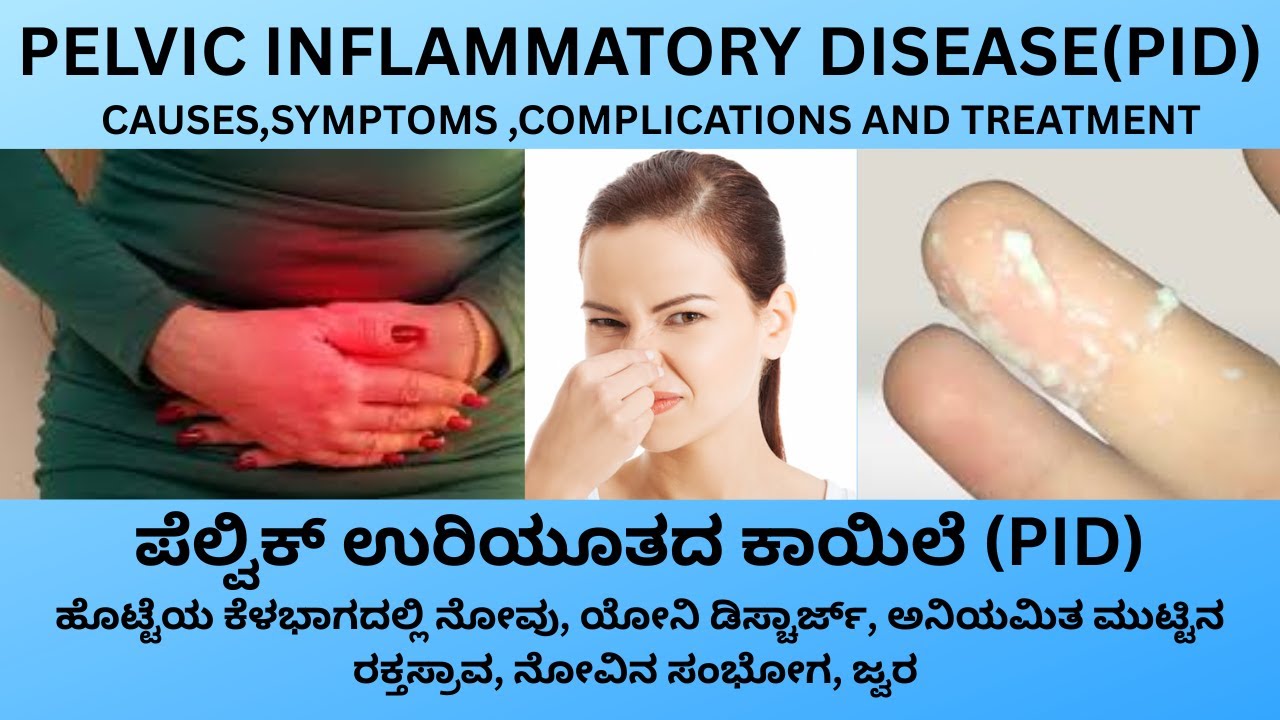 PELVIC INFLAMMATORY DISEASE(PID) CAUSES SYMPTOMS AND TREATMENT IN KANNADA.ಪೆಲ್ವಿಕ್ ಉರಿಯೂತದ ಕಾಯಿಲೆ
