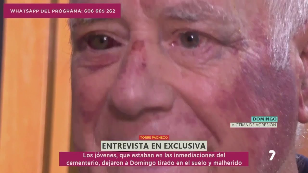 Domingo, víctima de la agresión en Torre Pacheco: 