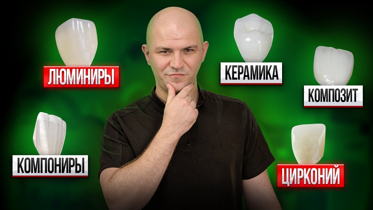 Какие Виниры Выбрать в 2026? Все виды виниров в 1 видео.