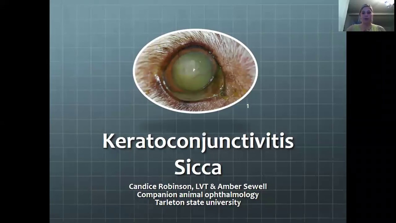 Keratoconjunctivitis Sicca