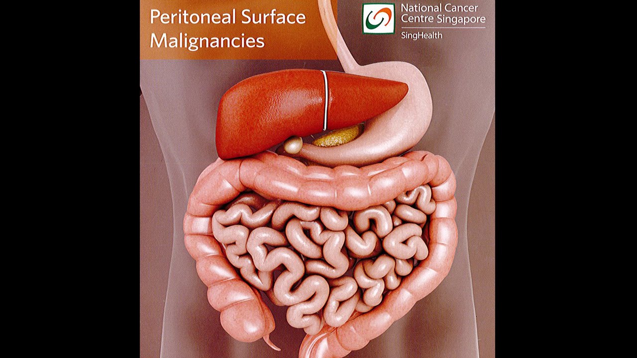All About Peritoneal Tumours: Causes, Symptoms, Diagnosis and Treatment