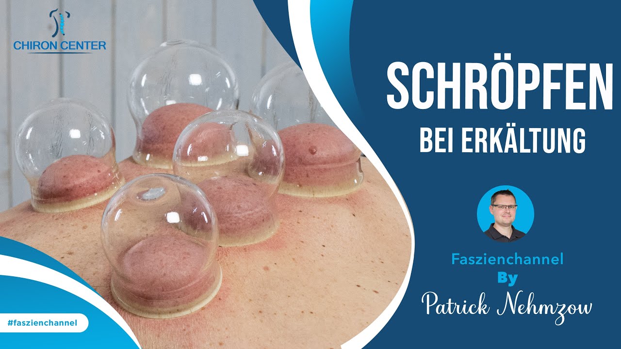 Tipps gegen Erkältungen: Schröpfen um die Selbstheilungskräfte zu aktivieren.