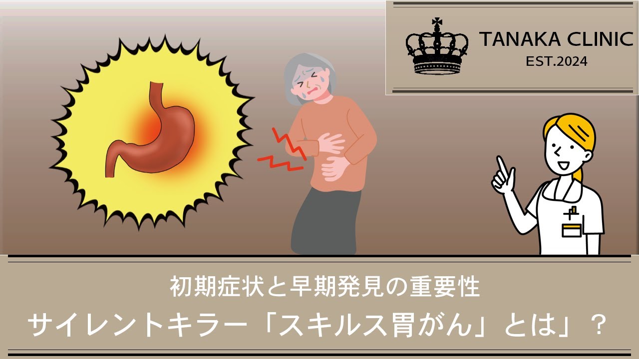42　サイレントキラー「スキルス胃がんとは」?　初期症状と早期発見の重要性｜【胃腸と内視鏡の専門チャンネル】たなか内科クリニック