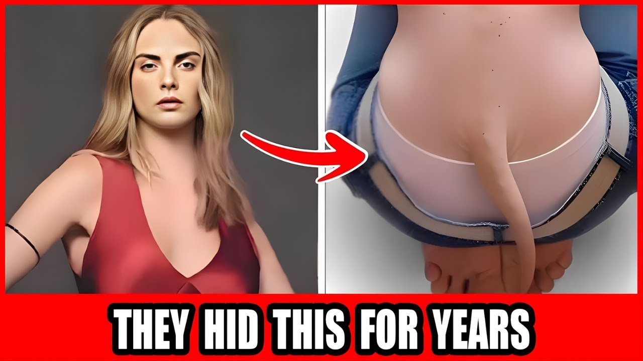 18 Celebrities With Shocking Body Deformities They Tried To Hide