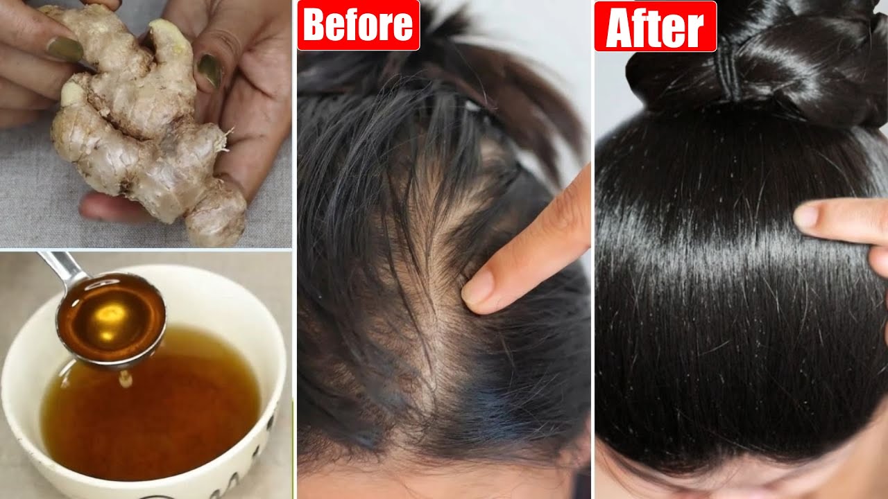 I tried this-Hair Transforming Ginger Hair Oil-Got Double Hair Growth in 1 Month-Apply only on Scalp