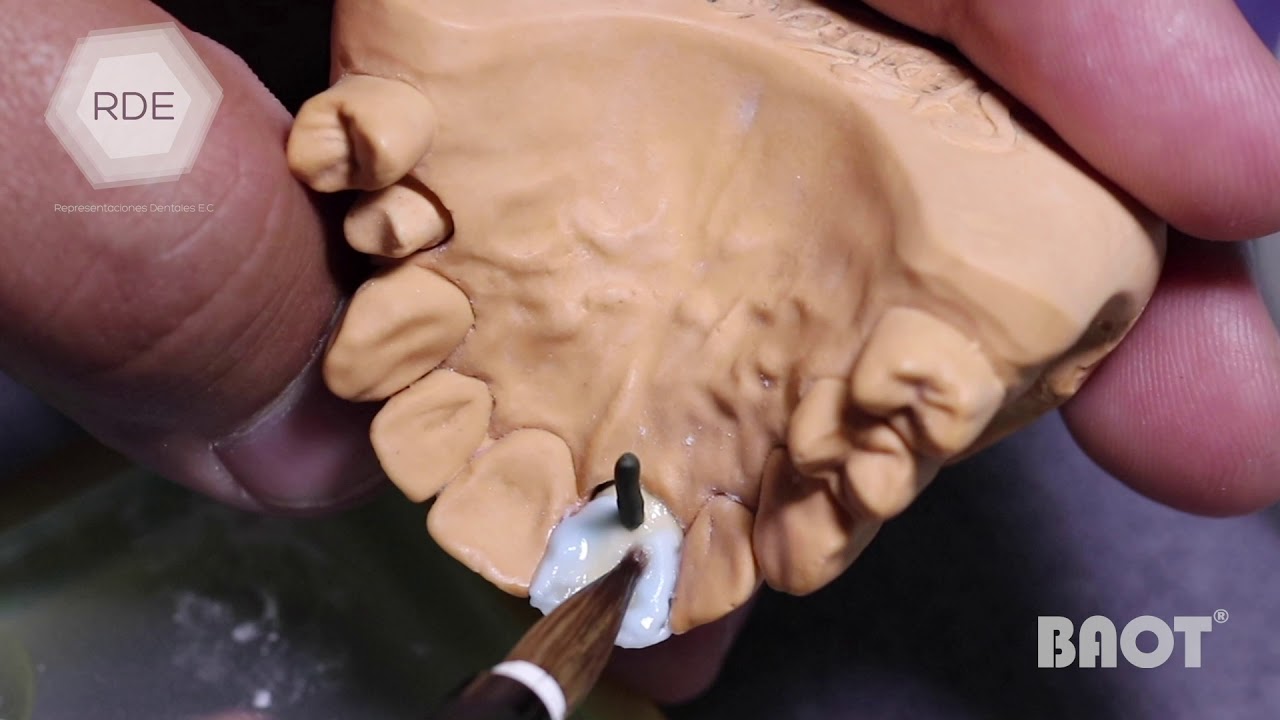 Curso JC BAOT  Ecuador Patricio Castillo