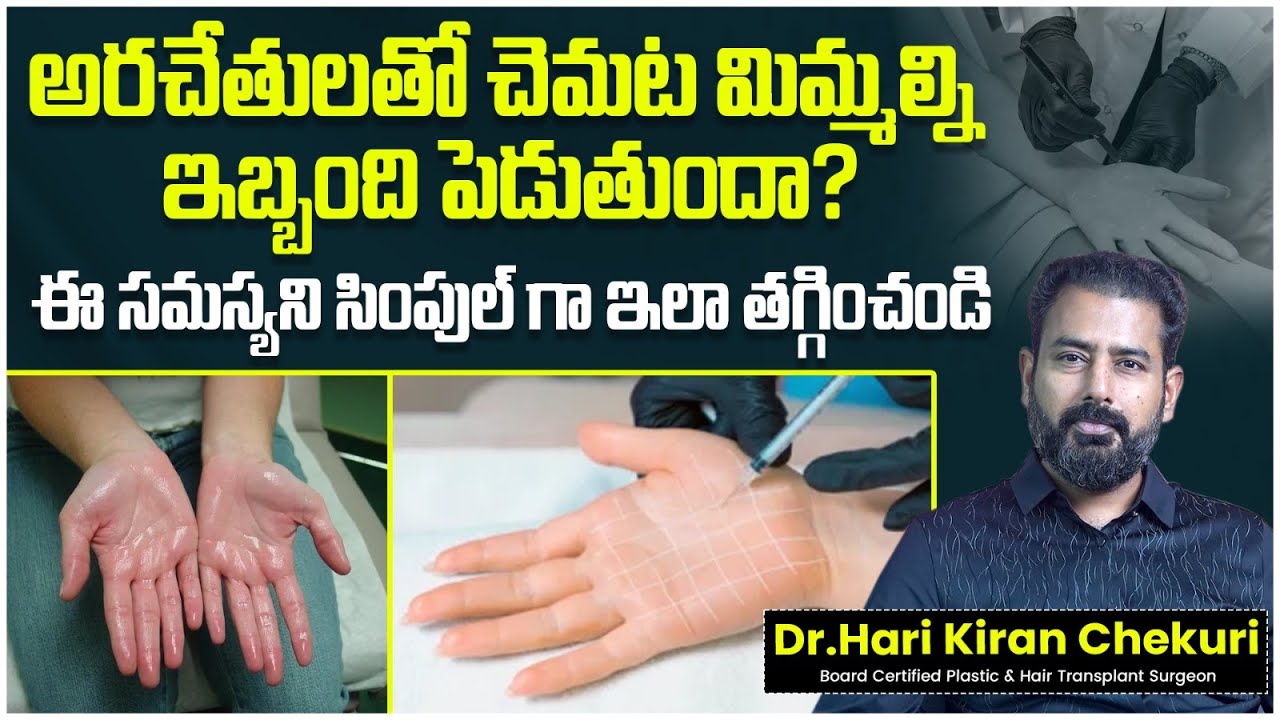 Hyperhidrosis Treatment in Telugu || How to Cure Sweaty Palms Permanently || ReDefine Channel