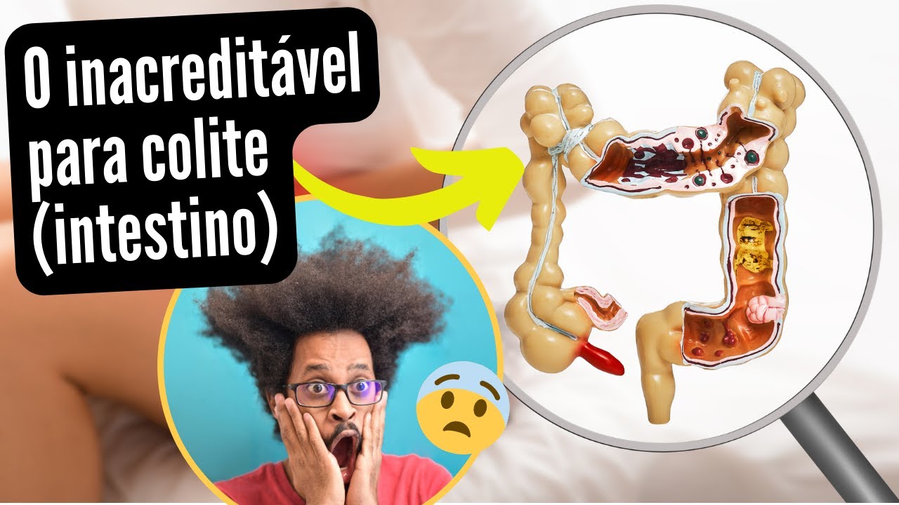 MELHOR CHÁ PARA COLITE #nutricionista_gustavo