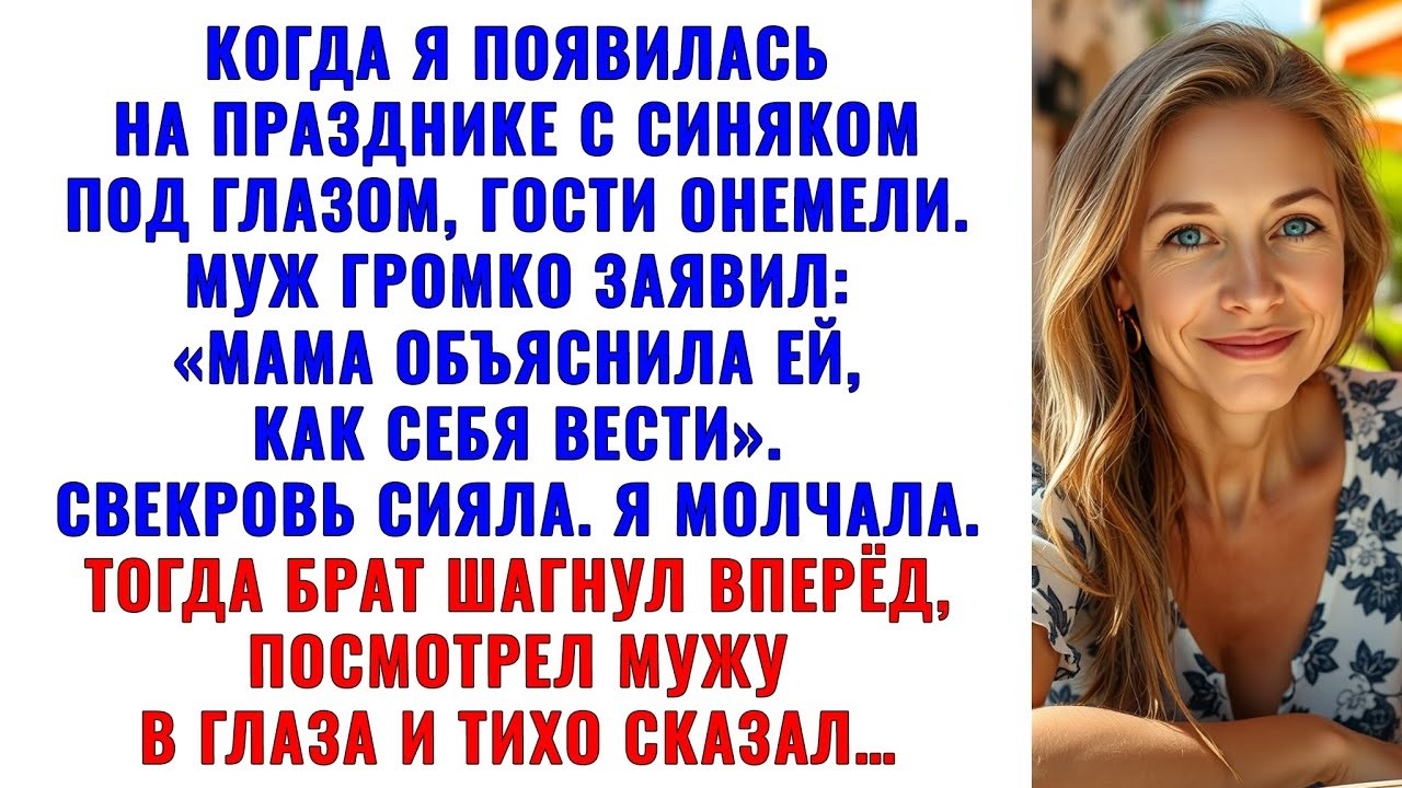 Когда я появилась на празднике с синяком под глазом, гости онемели