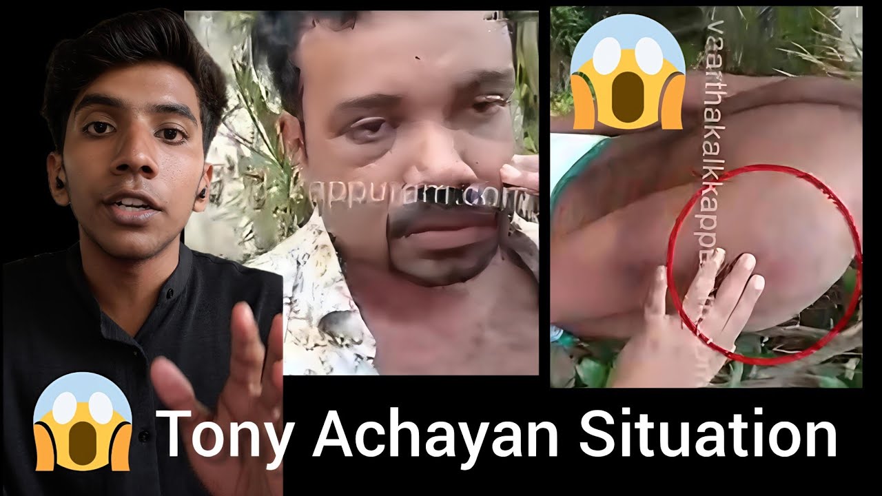 Tony Achayan | നല്ലത്ത് ച്ചെയ്താലും അവസ്ഥ ഇത് തന്നെ 😵🙏