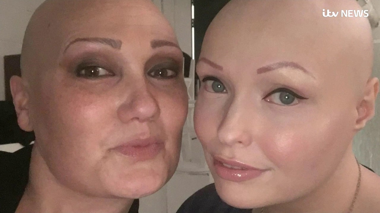 The women showing that alopecia can be beautiful | ITV News