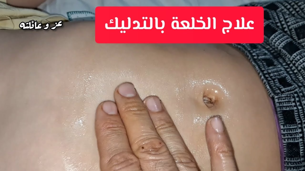 علاج الخلعة والخوف بالتدليك فوق السرة - الفجعة والخلعة في المعدة