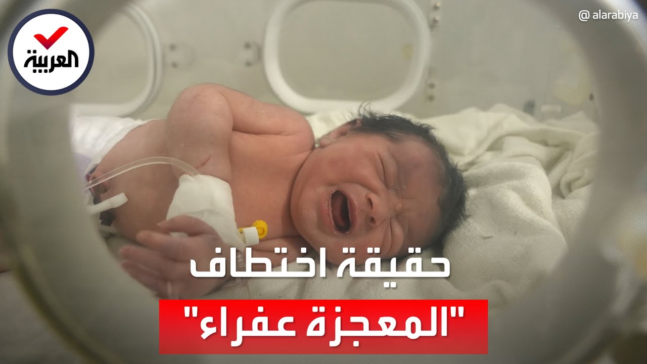مسلحون يقتحمون مستشفى يتولى رعاية الطفلة عفراء 