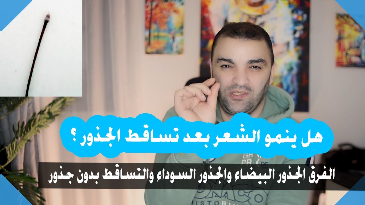 شعرك بيقع وفي اخره نقطة سودة | ادخل او ادخلي شوف السبب والعلاج