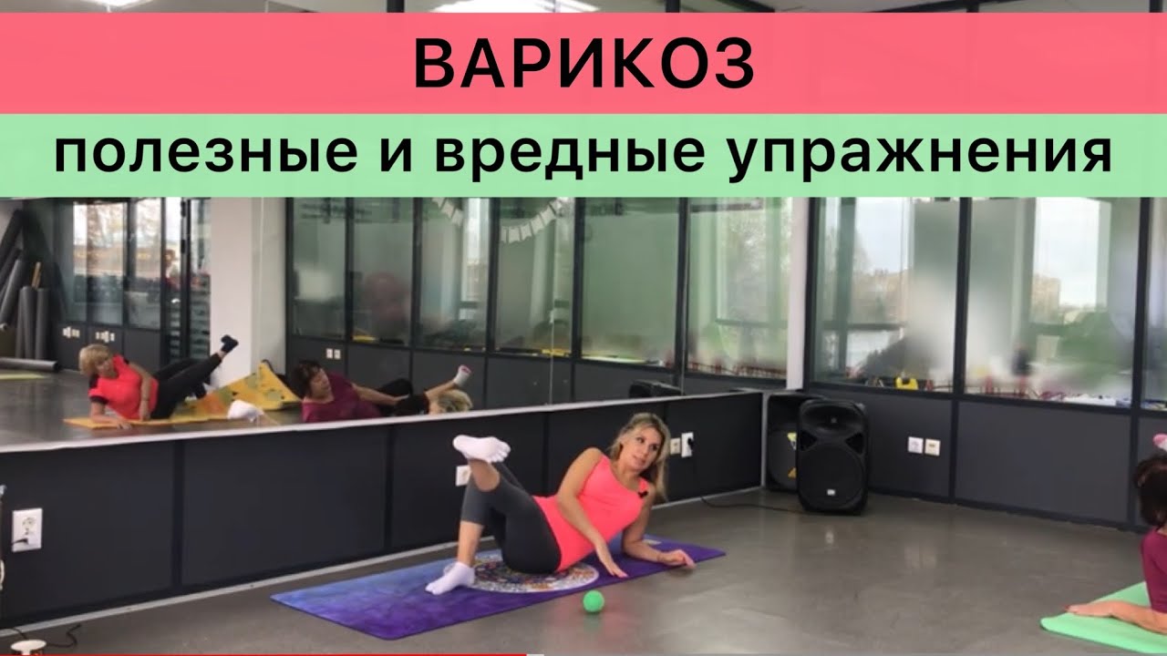 Варикоз.Полезные и вредные упражнения.