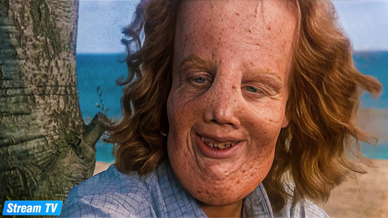 Based On A True Story - Meet Rocky Dennis