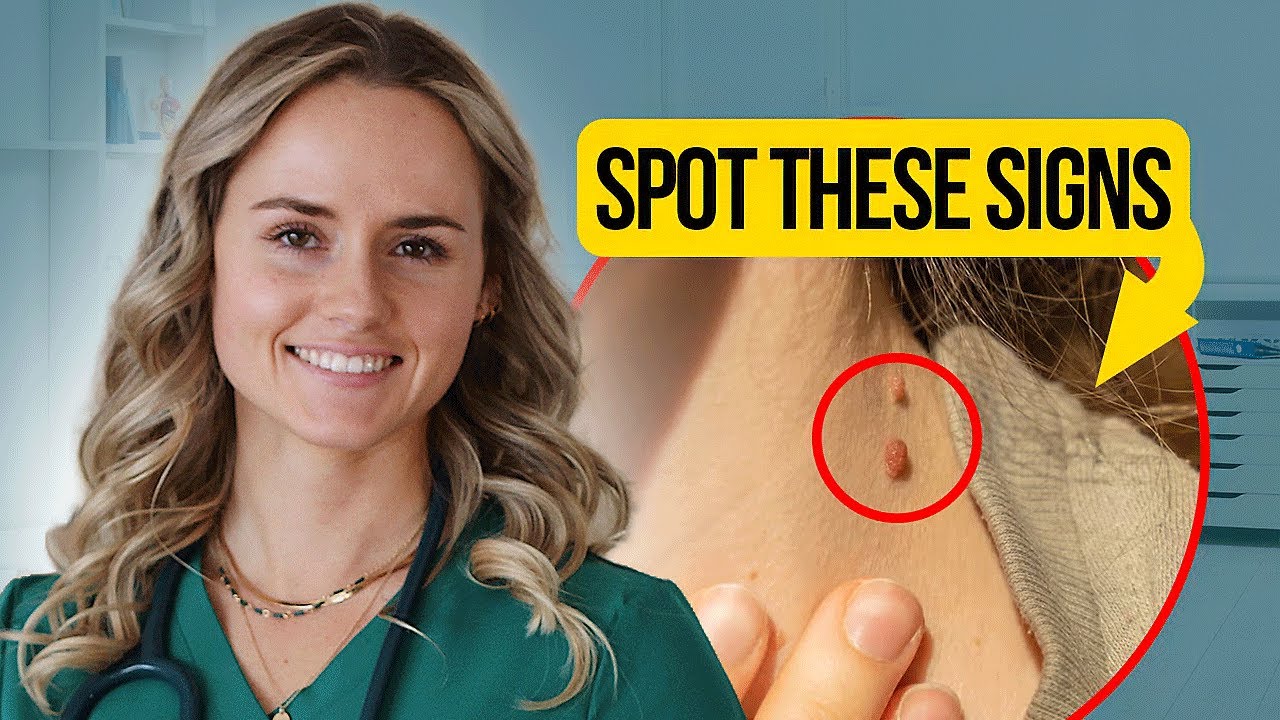 Как определить наличие инсулинорезистентности (без анализов крови)