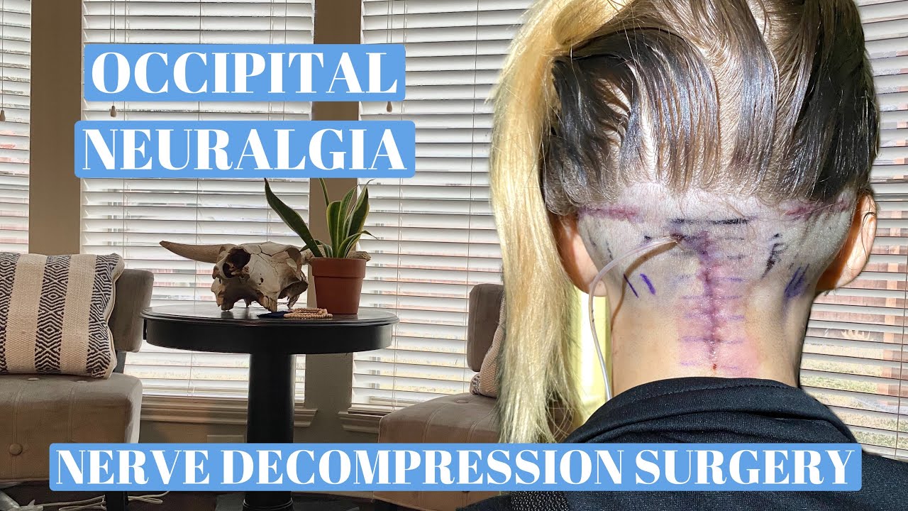 Occipital neuralgia Nerve decompression surgery recovery