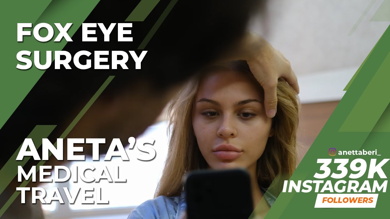 Fox Eye Surgery in Turkey / Fox Eyes Lift Experience