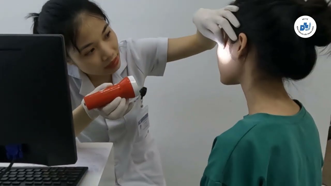Quy trình điều trị mụn trứng cá tại Bệnh viện Da liễu Trung ương