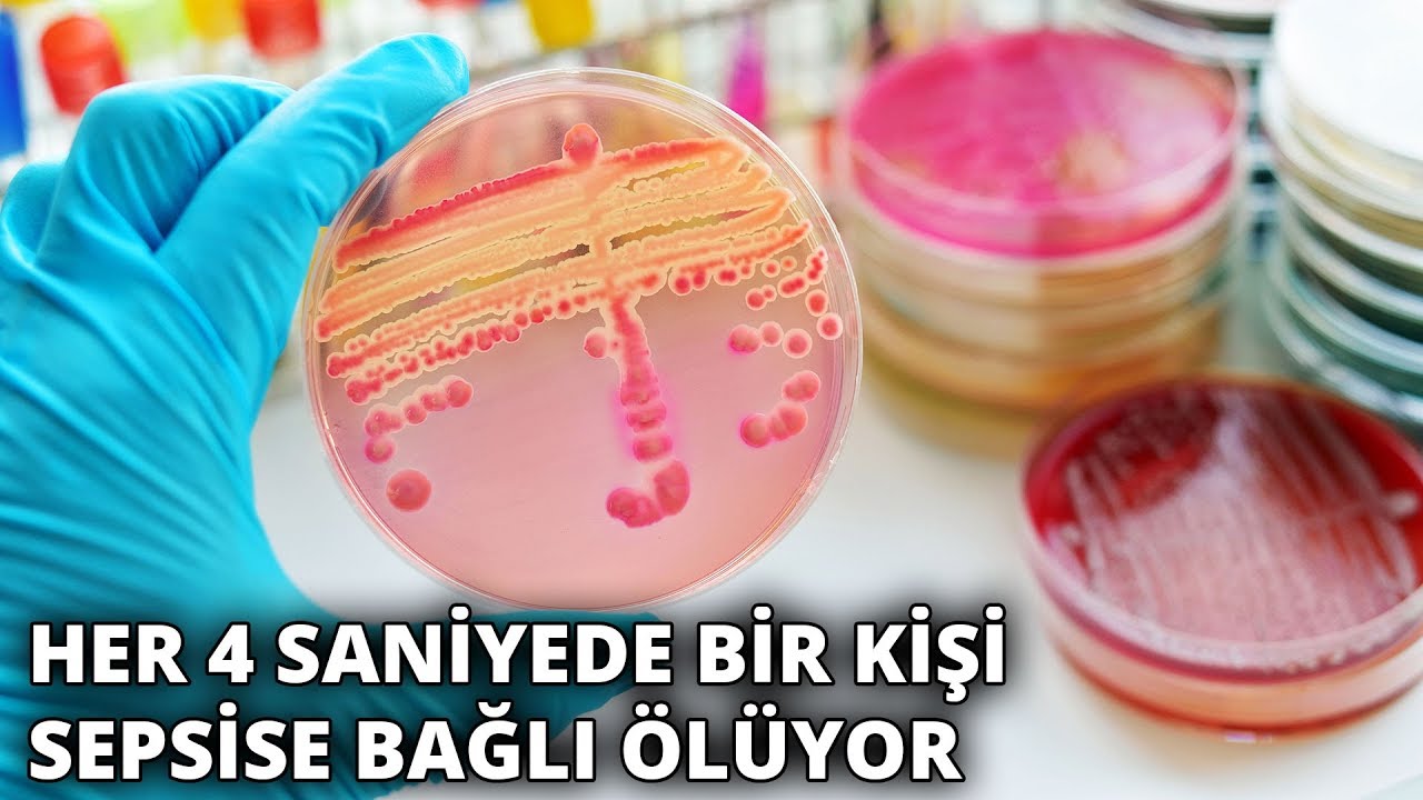 Bilinçsiz antibiyotik kullanımı sepsis tedavisini güçleştiriyor