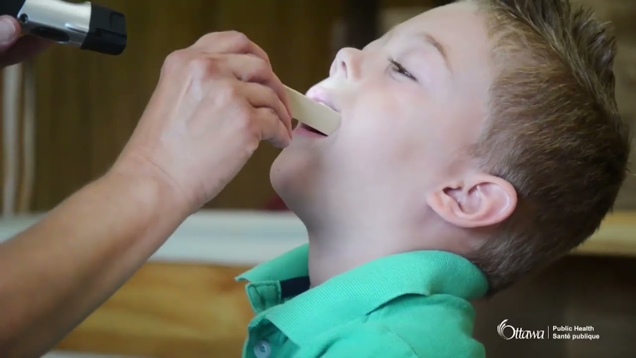 Dental Screenings at Schools by Ottawa Public Health - 2026