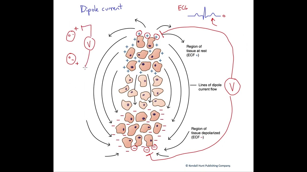Dipole current (EKG)