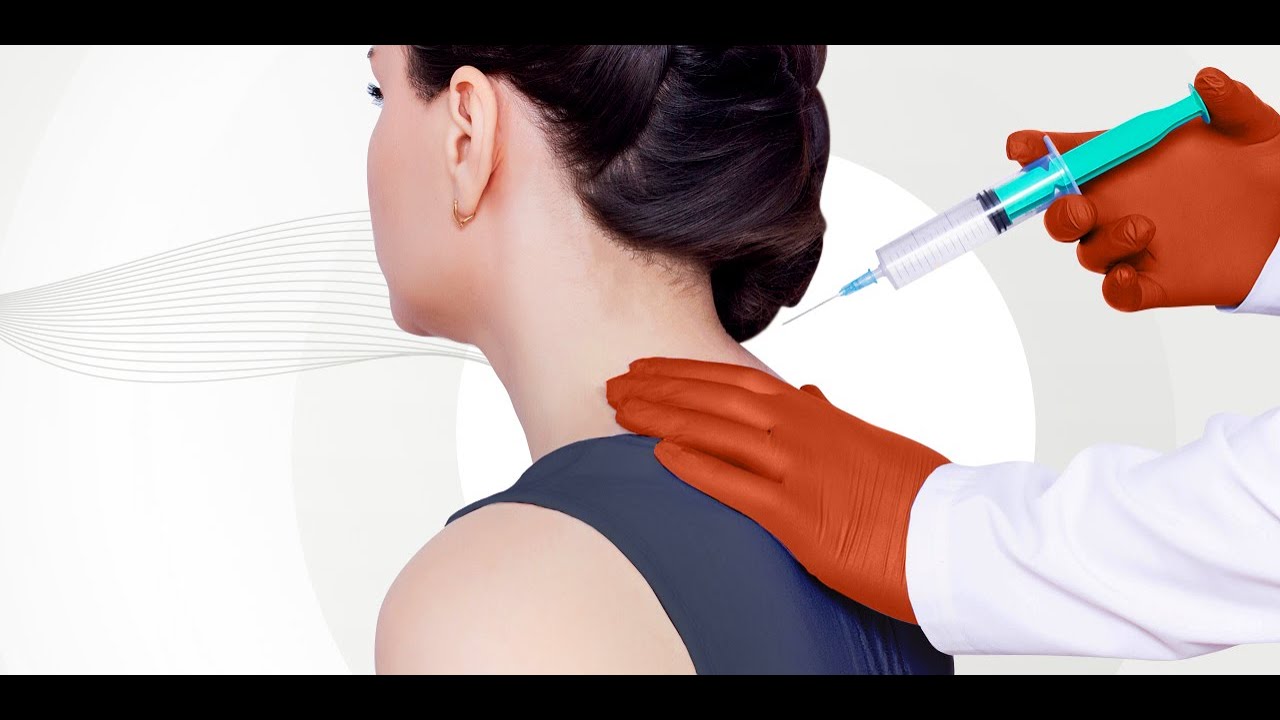 Cervical Epidural Steroid Injection: Success Rates and Risk