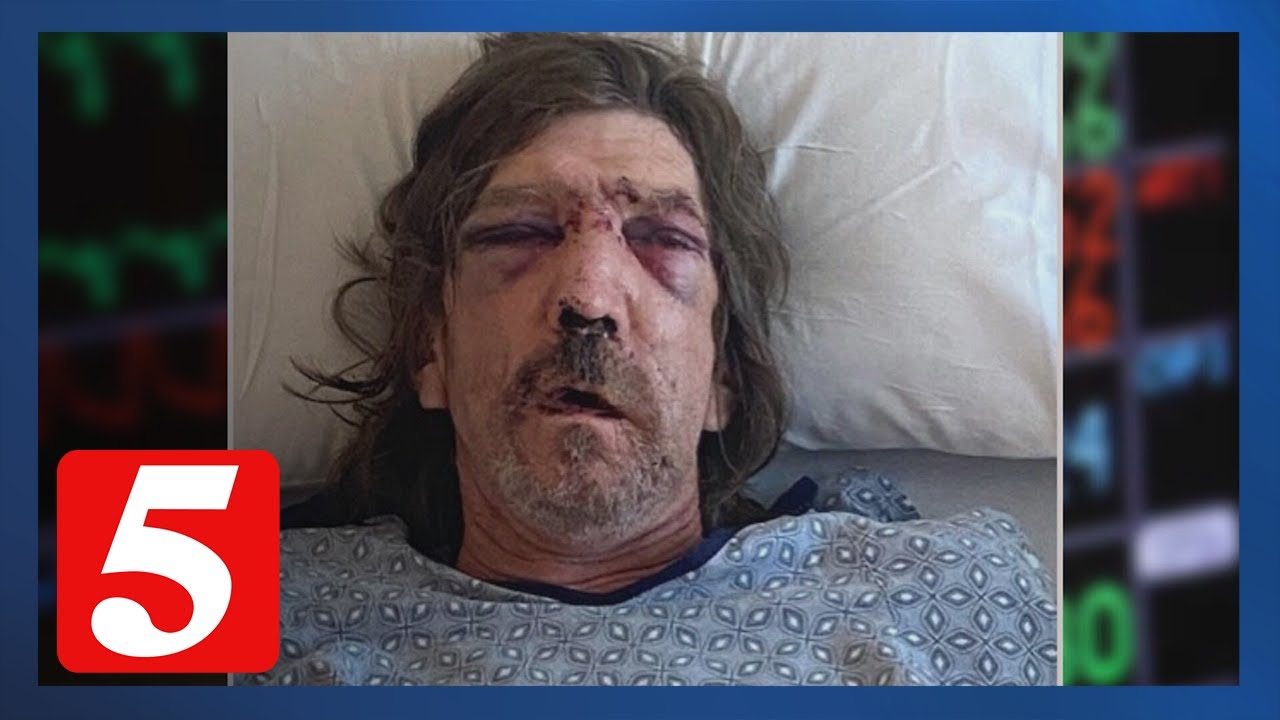 Deputies face federal charges for excessive use of force and lying to investigators