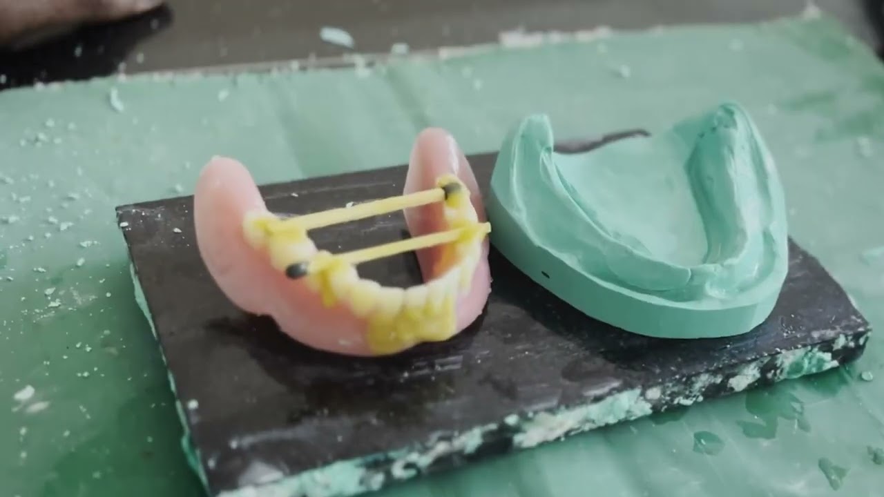 Denture Repair - Prosthodontics