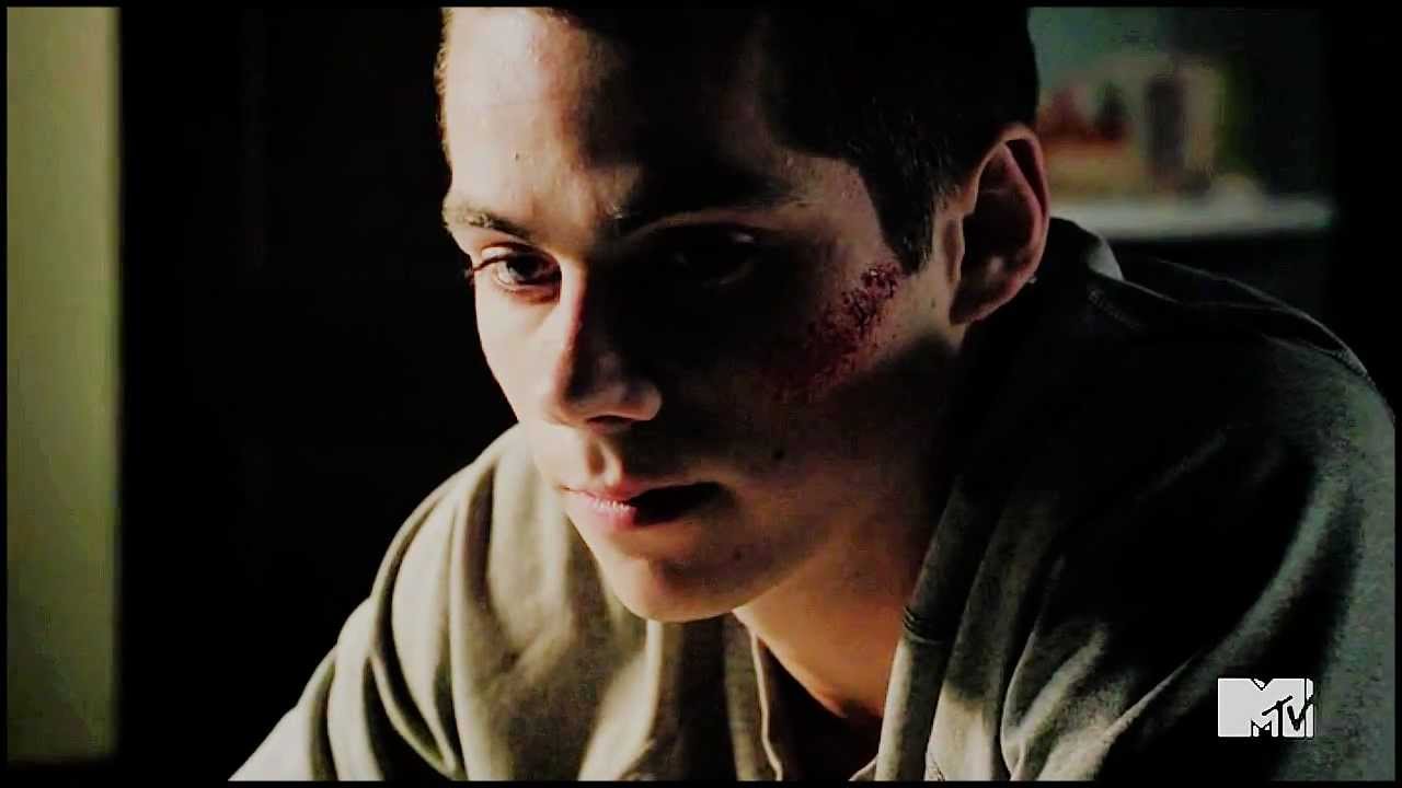 Wonderwall - Teen Wolf [200+ subscribers]