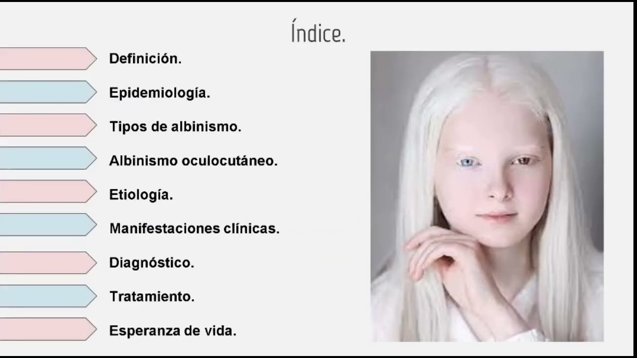 Albinismo