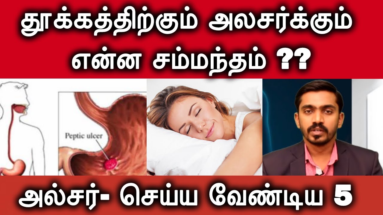 தூக்கம் அல்சரை பாதிக்குமா? | அல்சரை குணமாக்க  இந்த 5 ம் வேண்டும் l 5 Do's of ULCER l DrSJ