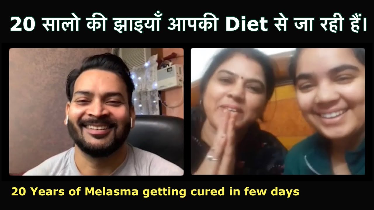 20 Years of Melasma/Pigmentation getting cured in just few days with Diet. Whole Family is your Fan