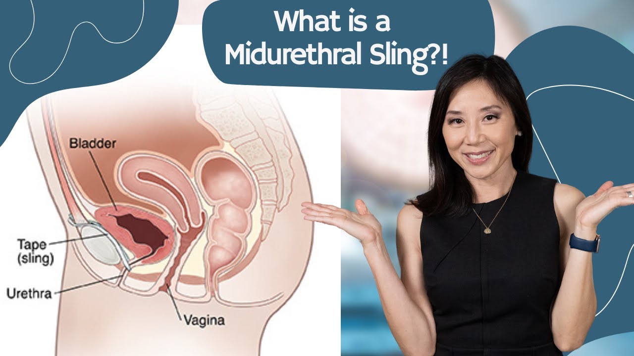 What is a Midurethral Sling?!