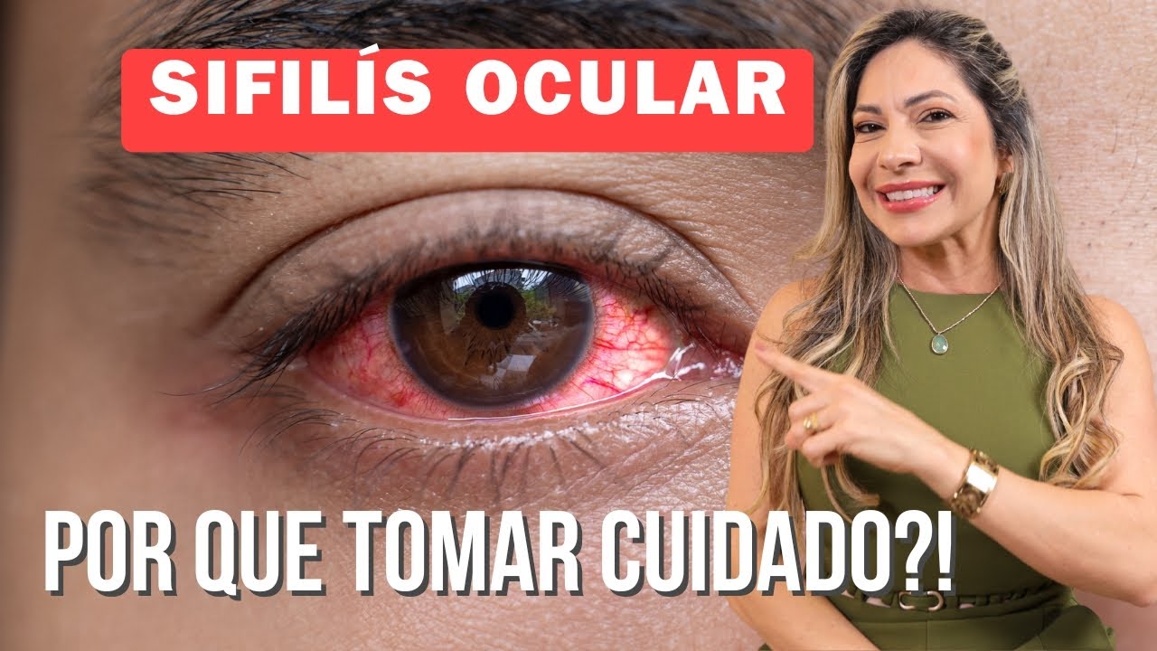 Cuidado: A S&iacute;filis Pode Atingir Seus Olhos!
