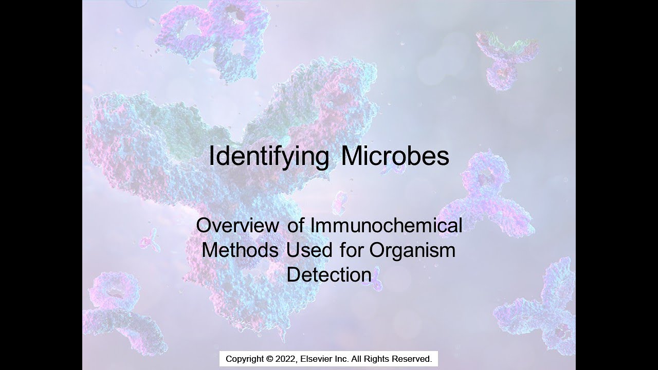 Microbial Identification: Immunochemical Techniques