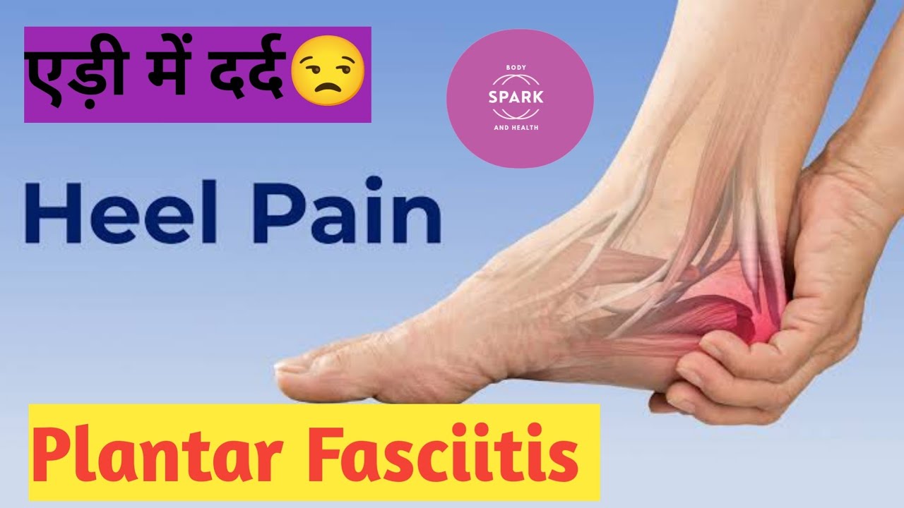 Heel Pain | Plantar Fasciitis Treatment at Home | Physiotherapy Tips #heelpain #plantarfasciitis  