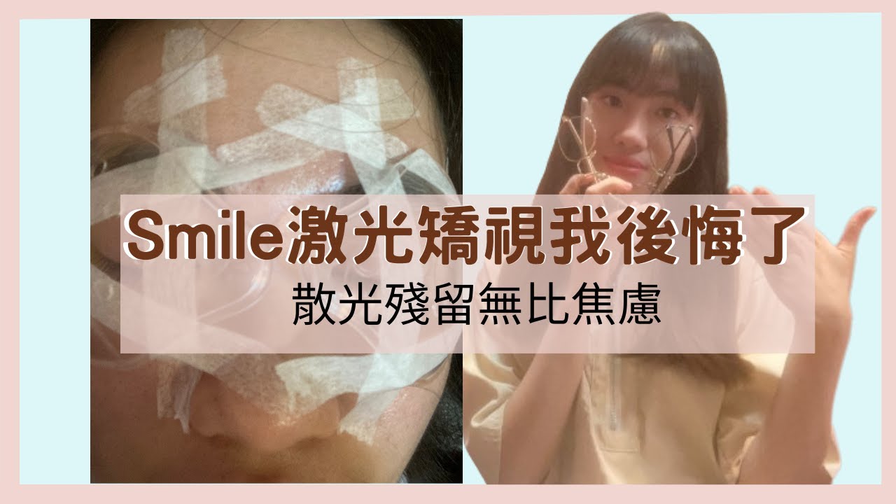 【Smile激光矯視我後悔了】︱散光殘留問題🫠︱手術一個月無比焦慮😢︱smile會盲嗎?🫣︱看見鬼火了!🔥︱Smile 價錢分享 ︱ 手術會痛嗎?👩︱散光殘留無比焦慮︱
