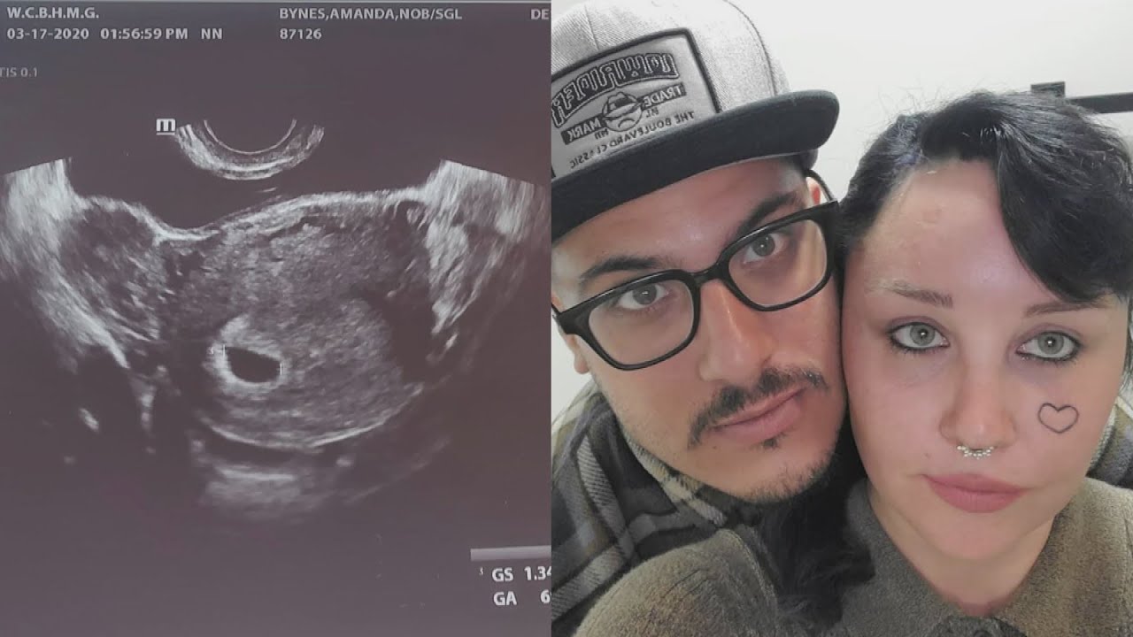 Amanda Bynes Announces She’s Pregnant With First Baby